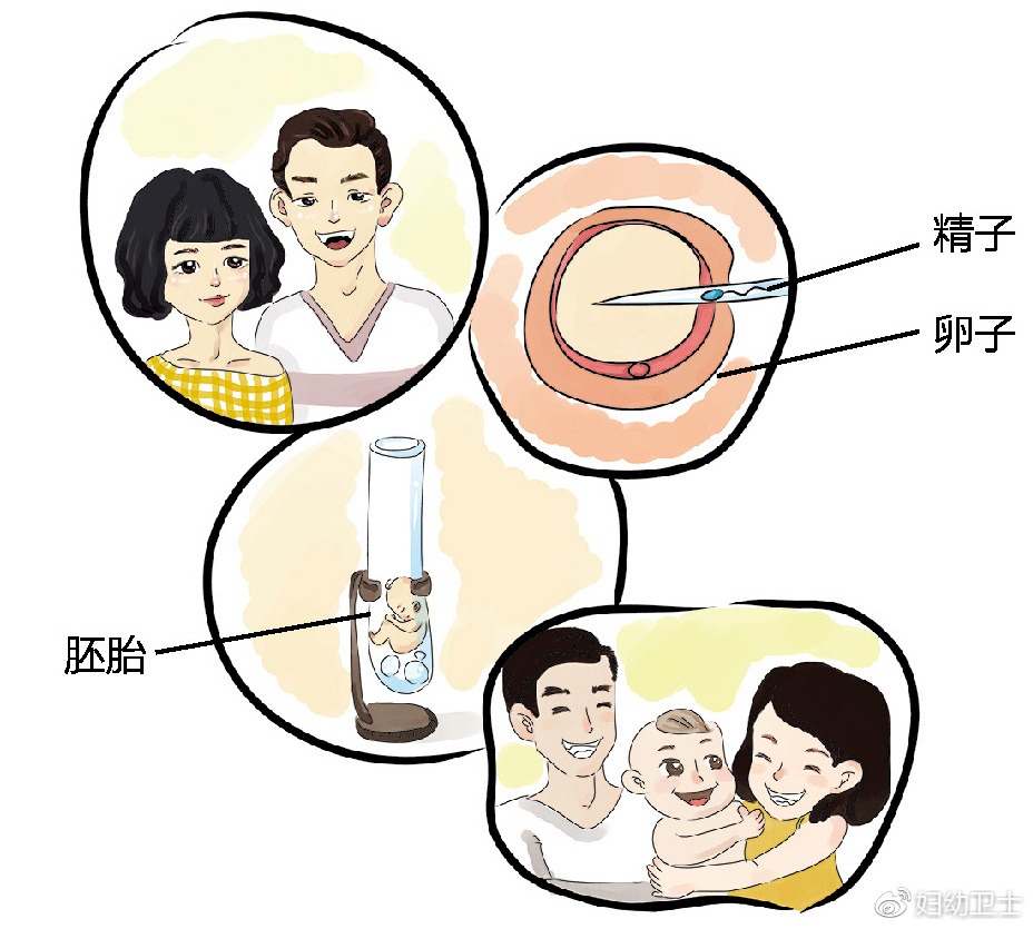 海外不孕不育治疗