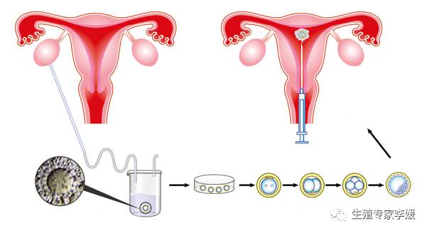 海外试管婴儿机构