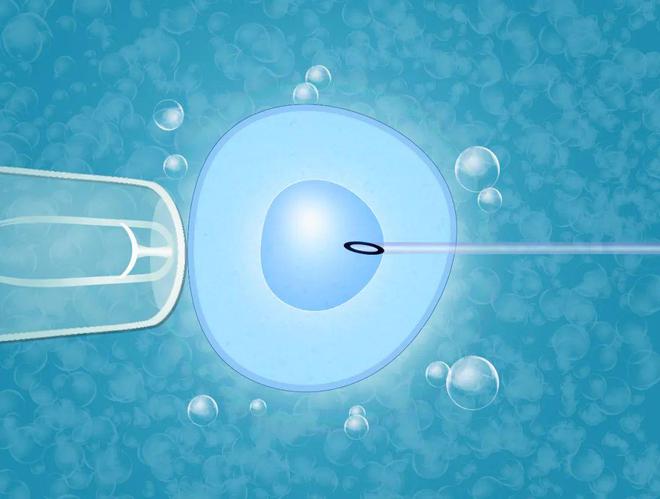 泰国高龄试管婴儿