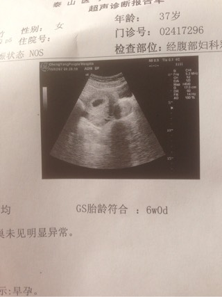 济南试管婴儿费用