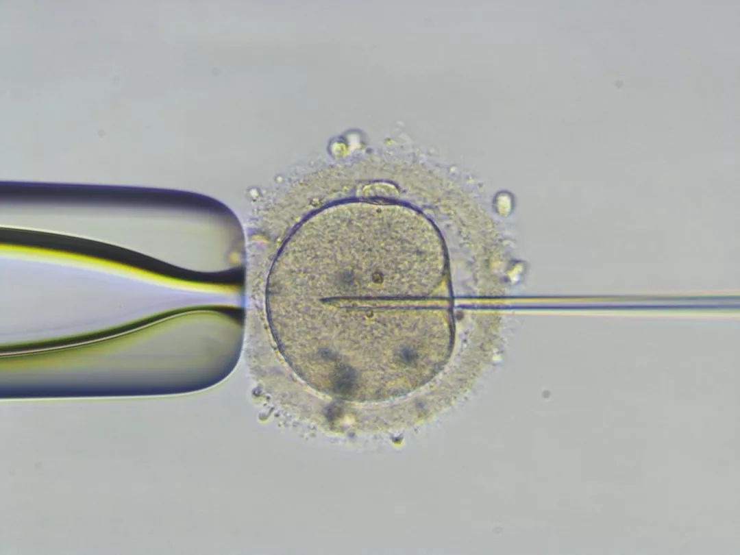 海外试管婴儿服务公司