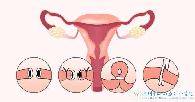 海外不孕不育治疗