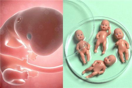 海外试管婴儿医院