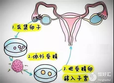 浙江试管婴儿医院